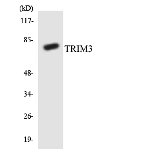 Western blot analysis of the lysates from Jurkat cells using TRIM3 antibody.