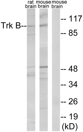 Western blot analysis of lysates from rat brain and mouse brain, treated with PBS 60', using Trk B Antibody. The lane on the right is blocked with the synthesized peptide.