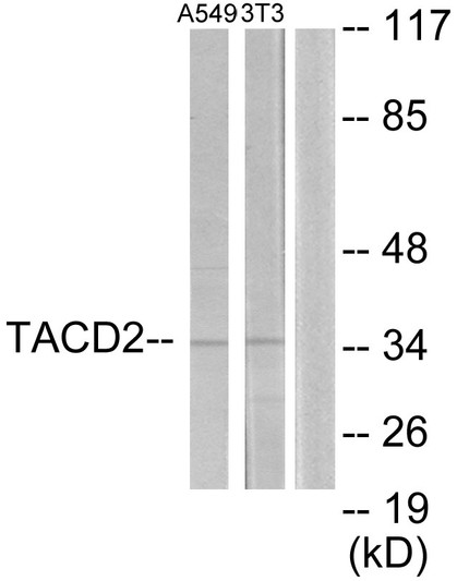 Western blot analysis of lysates from A549 and NIH/3T3 cells, using TACD2 Antibody. The lane on the right is blocked with the synthesized peptide.
