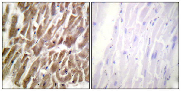 Immunohistochemistry analysis of paraffin-embedded human heart tissue, using TNNI3 Antibody. The picture on the right is blocked with the synthesized peptide.