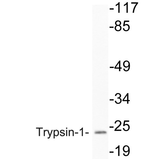 Western blot analysis of lysate from 293 cells, using Trypsin-1 antibody.