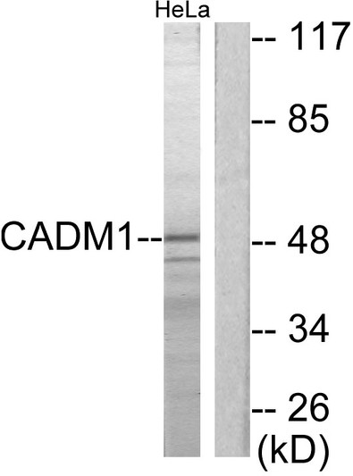 Western blot analysis of lysates from HeLa cells, using CADM1 Antibody. The lane on the right is blocked with the synthesized peptide.