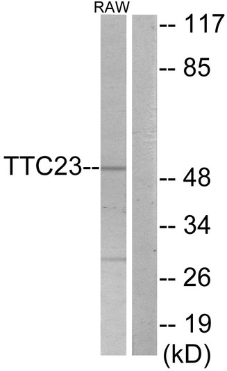Western blot analysis of lysates from RAW264.7 cells, using TTC23 Antibody. The lane on the right is blocked with the synthesized peptide.