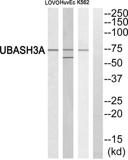 Western blot analysis of UBASH3A Antibody. The lane on the right is blocked with the UBASH3A peptide.
