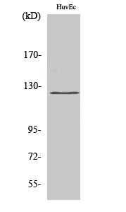 Western blot analysis of HuvEc cells using UBE3C Polyclonal Antibody. Secondary antibody was diluted at 1:20000 cells nucleus extracted by Minute TM Cytoplasmic and Nuclear Fractionation kit (SC-003, Inventbiotech, MN, USA).