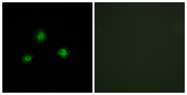 Immunofluorescence analysis of A549 cells, using Ubinuclein Antibody. The picture on the right is blocked with the synthesized peptide.