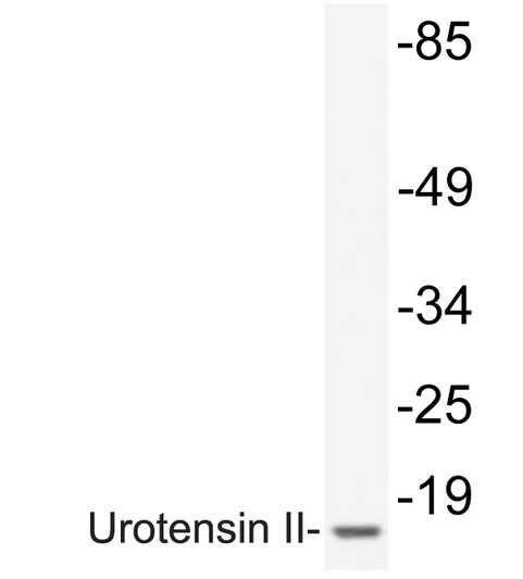 Western blot analysis of lysate from 293 cells, using Urotensin II antibody.