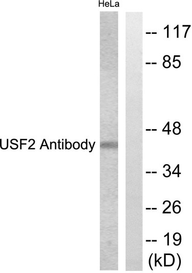 Western blot analysis of lysates from HeLa cells, using USF2 Antibody. The lane on the right is blocked with the synthesized peptide.