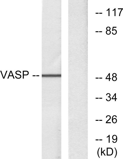 Western blot analysis of lysates from NIH/3T3 cells, treated with forskolin 40 Mu M 30', using VASP Antibody. The lane on the right is blocked with the synthesized peptide.