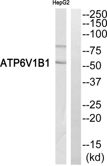 Western blot analysis of ATP6V1B1 Antibody. The lane on the right is blocked with the ATP6V1B1 peptide.