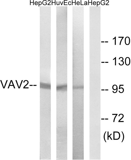 Western blot analysis of lysates from HepG2, HUVEC, and HeLa cells, using VAV2 Antibody. The lane on the right is blocked with the synthesized peptide.