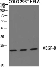 Western blot analysis of various cells using VEGF-B polyclonal antibody diluted at 1:2000. Secondary antibody STJ96236