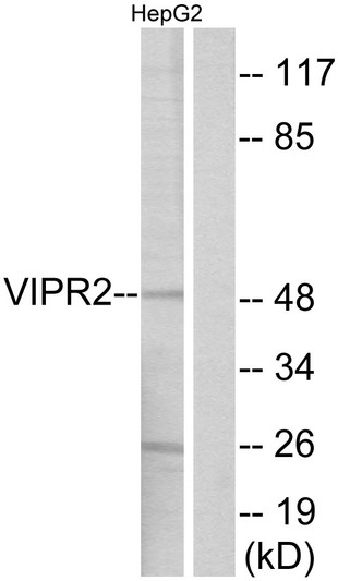 Western blot analysis of lysates from HepG2 cells, using VIPR2 Antibody. The lane on the right is blocked with the synthesized peptide.