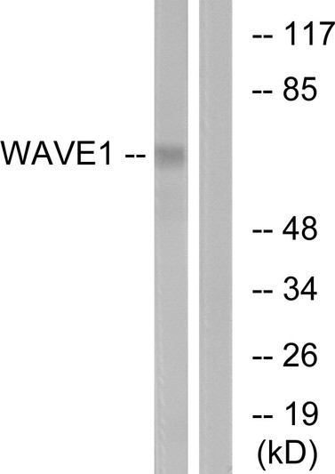 Western blot analysis of lysates from 293 cells, treated with insulin 0.01U/ml 15', using WAVE1 Antibody. The lane on the right is blocked with the synthesized peptide.
