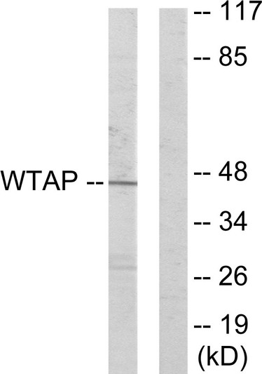 Western blot analysis of lysates from HUVEC cells, using WTAP Antibody. The lane on the right is blocked with the synthesized peptide.