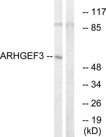 Western blot analysis of lysates from COLO cells, using ARHGEF3 Antibody. The lane on the right is blocked with the synthesized peptide.