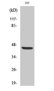 Western blot analysis of various cells using ZAR1 polyclonal antibody. Secondary antibody was STJ96298