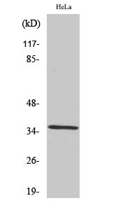 Western blot analysis of various cells using ZIS polyclonal antibody. Secondary antibody was diluted STJ96317