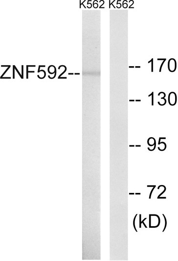 Western blot analysis of lysates from K562 cells, using ZNF592 Antibody. The lane on the right is blocked with the synthesized peptide.