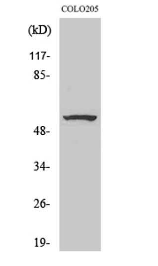 Western blot analysis of various cells using ZNF682 Polyclonal Antibody. Secondary antibody was diluted at 1:20000 cells nucleus extracted by Minute TM Cytoplasmic and Nuclear Fractionation kit (SC-003, Inventbiotech, MN, USA).