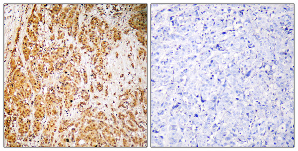 Immunohistochemistryt analysis of paraffin-embedded human brain, using ZSCAN22 Antibody. The lane on the right is blocked with the ZSCAN22 peptide. Immunohistochemistryt analysis of paraffin-embedded human brain, using ZSCAN22 Antibody. The lane on the right is blocked with the ZSCAN22 peptide.