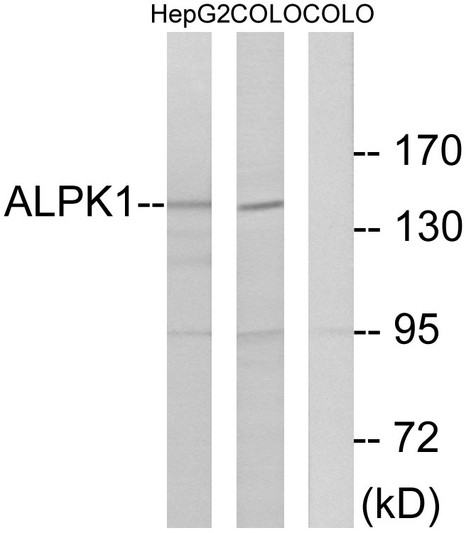 Western blot analysis of lysates from COLO and HepG2 cells, using ALPK1 Antibody. The lane on the right is blocked with the synthesized peptide.