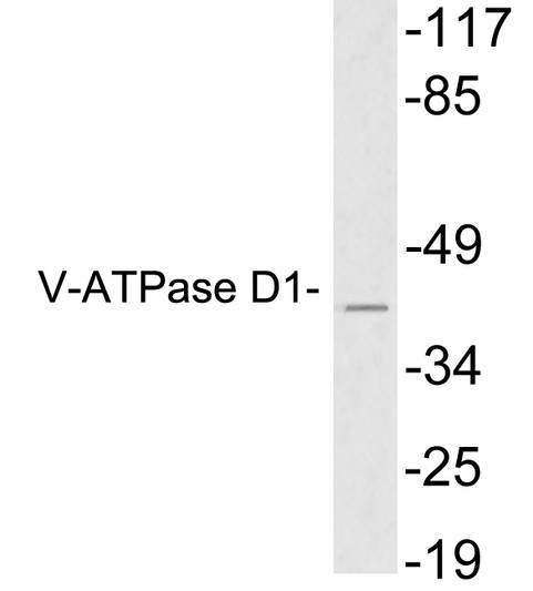Western blot analysis of lysates from HeLa cells, using V-ATPase D1 antibody.