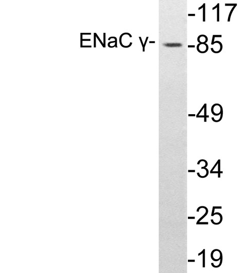 Western blot analysis of lysates from A549 cells, using ENaC Gamma antibody.