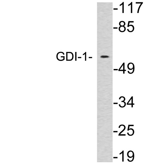 Western blot analysis of lysates from brain tissue, using GDI-1 antibody.