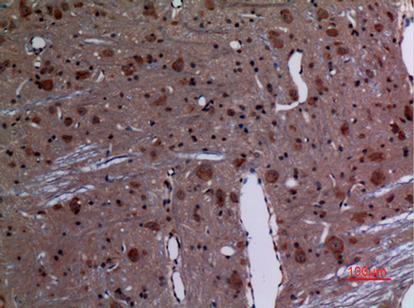 Immunohistochemical analysis of paraffin-embedded rat-brain, antibody was diluted at 1:100