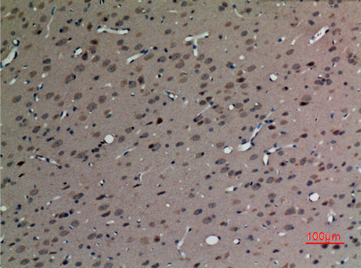 Immunohistochemical analysis of paraffin-embedded rat-brain, antibody was diluted at 1:100
