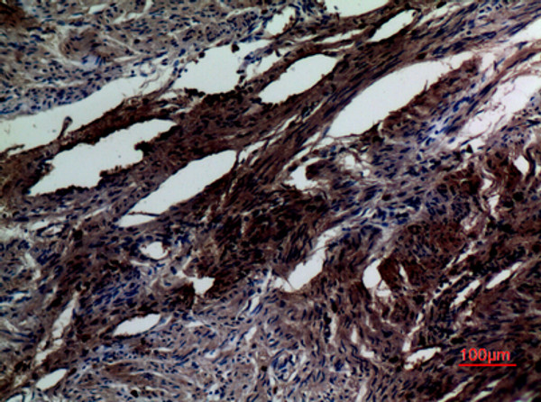 Immunohistochemical analysis of paraffin-embedded human-uterus, antibody was diluted at 1:100
