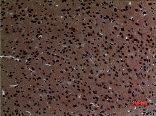 Immunohistochemical analysis of paraffin-embedded mouse-brain, antibody was diluted at 1:100 Immunohistochemical analysis of paraffin-embedded mouse-brain, antibody was diluted at 1:100