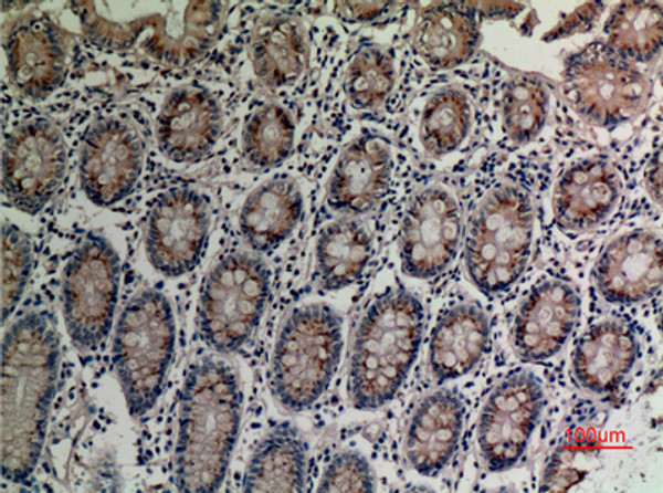 Immunohistochemical analysis of paraffin-embedded human-colon, antibody was diluted at 1:100 Immunohistochemical analysis of paraffin-embedded human-colon, antibody was diluted at 1:100