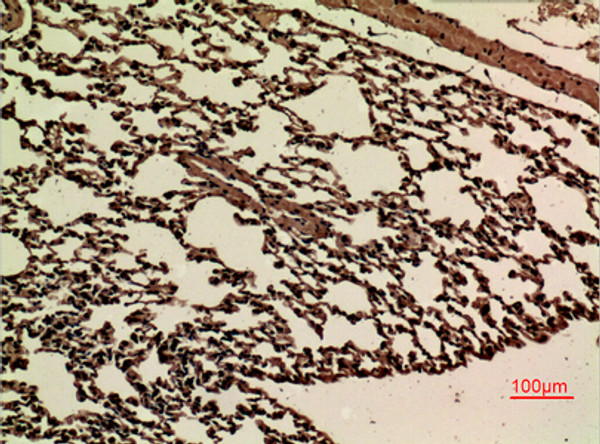Immunohistochemical analysis of paraffin-embedded mouse-lung, antibody was diluted at 1:100