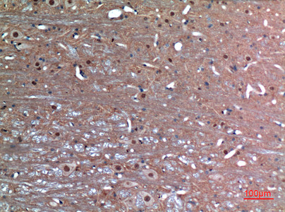 Immunohistochemical analysis of paraffin-embedded rat-brain, antibody was diluted at 1:100