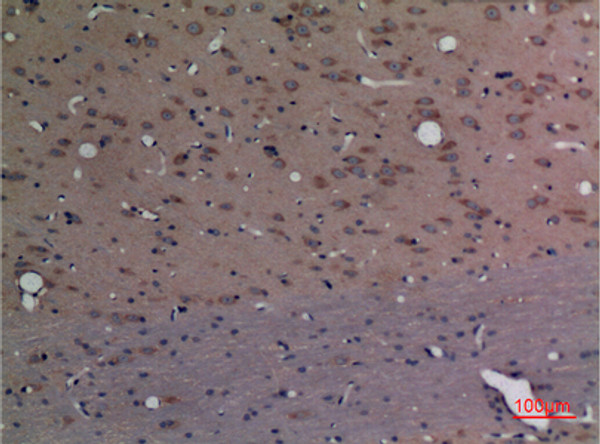 Immunohistochemical analysis of paraffin-embedded rat-brain, antibody was diluted at 1:100 Immunohistochemical analysis of paraffin-embedded rat-brain, antibody was diluted at 1:100