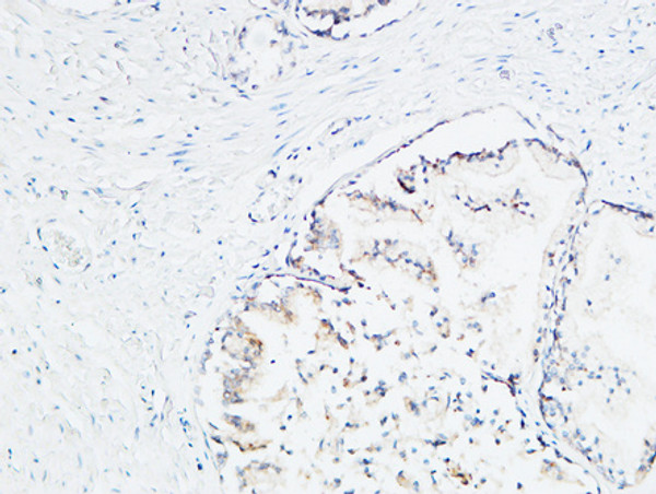 Immunohistochemical analysis of paraffin-embedded Human Prostate. 1, Antibody was diluted at 1:100 (4°C overnight). 2, High-pressure and temperature EDTA, pH8.0 was used for antigen retrieval. 3, Secondary antibody was diluted at 1:200 (room temperature, 30min).