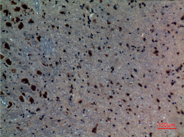 Immunohistochemical analysis of paraffin-embedded mouse-brain, antibody was diluted at 1:100