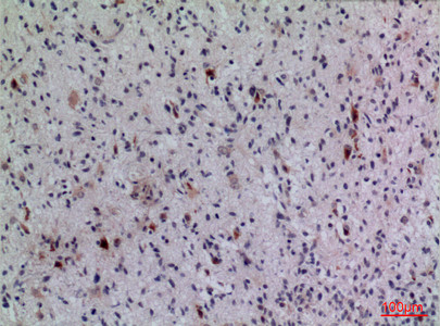 Immunohistochemical analysis of paraffin-embedded human-brain, antibody was diluted at 1:100