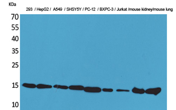 Western blot analysis of 293, HepG2, A549, SHSY5Y, PC-12, BXPC-3, Jurkat, mouse kidney, mouse lung cells using CyPA Polyclonal Antibody.. Secondary antibody was diluted at 1:20000