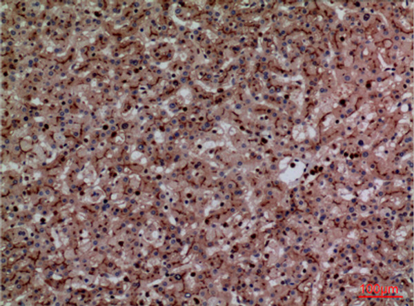 Immunohistochemical analysis of paraffin-embedded human-liver, antibody was diluted at 1:100