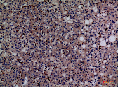 Immunohistochemical analysis of paraffin-embedded human-liver, antibody was diluted at 1:100