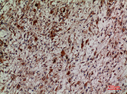 Immunohistochemical analysis of paraffin-embedded human-brain, antibody was diluted at 1:100