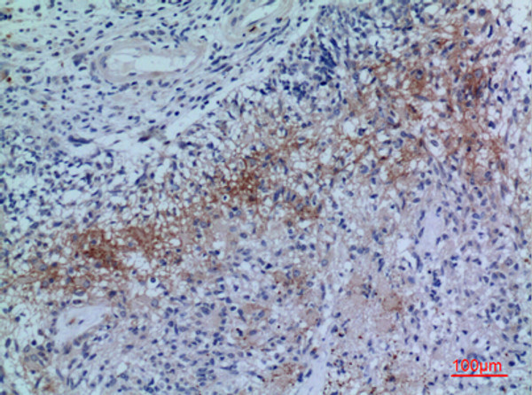 Immunohistochemical analysis of paraffin-embedded human-brain, antibody was diluted at 1:100