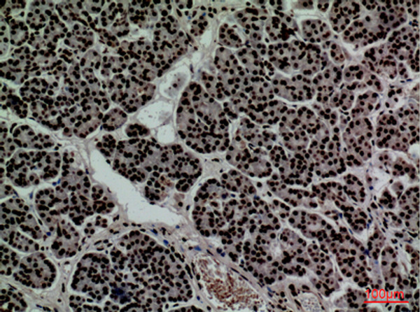 Immunohistochemical analysis of paraffin-embedded human-pancreas, antibody was diluted at 1:100 Immunohistochemical analysis of paraffin-embedded human-pancreas, antibody was diluted at 1:100