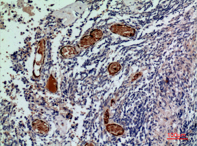 Immunohistochemical analysis of paraffin-embedded human-brain, antibody was diluted at 1:100