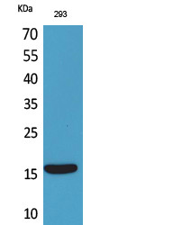 Western blot analysis of 293 cells using PSP polyclonal antibody. Secondary antibody was diluted at STJ96660