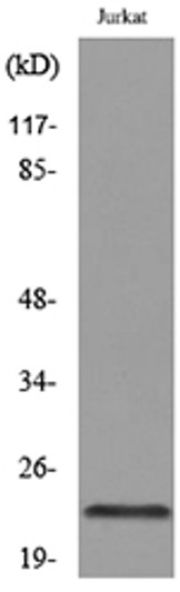 Western blot analysis of lysate from Jurkat cells, using IFNE Antibody.