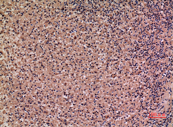 Immunohistochemical analysis of paraffin-embedded human-spleen, antibody was diluted at 1:100 Immunohistochemical analysis of paraffin-embedded human-spleen, antibody was diluted at 1:100